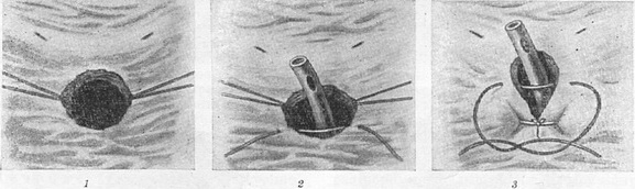 операція Харріса - Гринчака