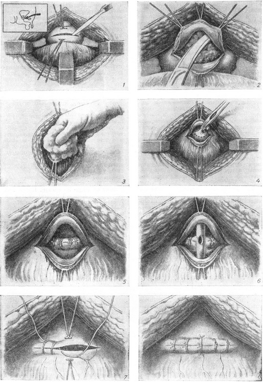 операція Лідського - Міллінова