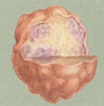 рак передміхурової залози