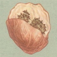 камені передміхурової залози