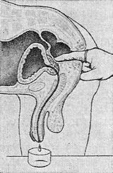 масаж простати фото