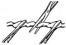 як перерізати пуповину