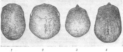 раси форми черепа