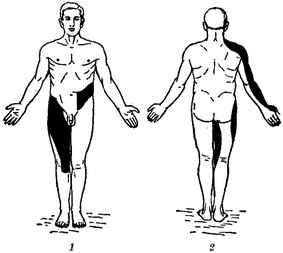 зони розлади чутливості корінцевого типу