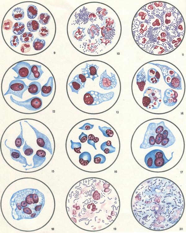ранової ексудат