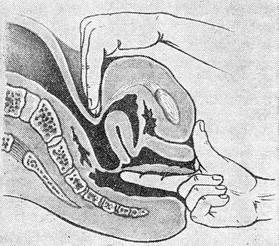 ректо-абдомінальне дослідження