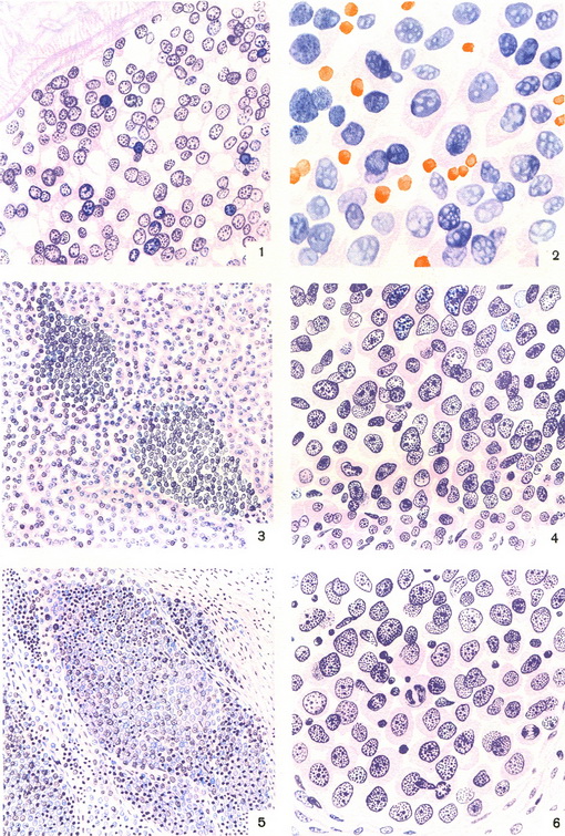 ретикулярні клітини