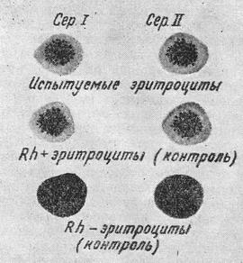 визначення резус-фактора