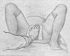 ручне допомога по Цовьянову