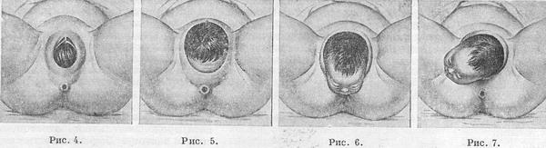 пологи (період вигнання)