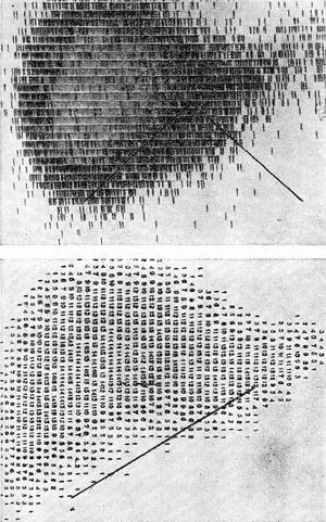 сканограма печінки