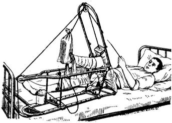 лікувальна шина Панкова