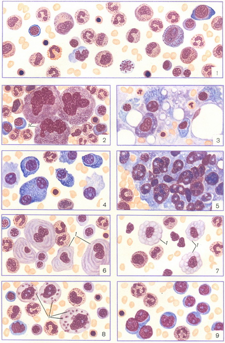кістковий мозок