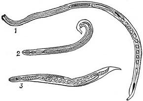 вугриця кишкова