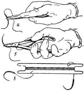 користування голкотримачем