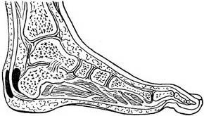 синовіальні сумки
