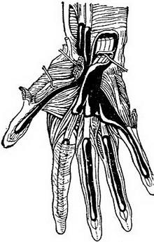 синовіальні піхви