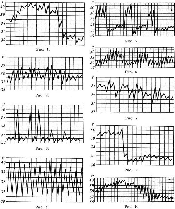 види температурних кривих