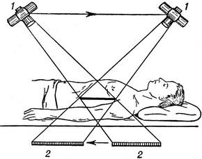 томографія