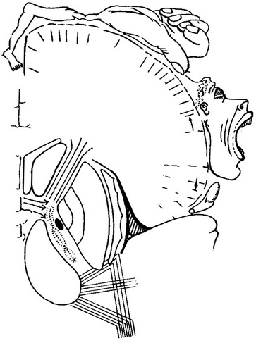 схема соматотопического розподілу м'язів