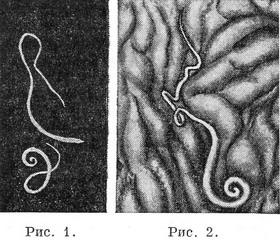 волосоголовець