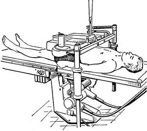 трохоскопия