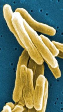 збудник туберкульозу