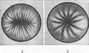 уретроскопія