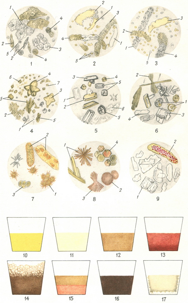 осад у сечі