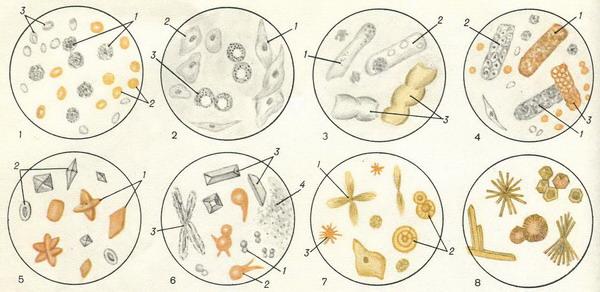 сеча мікроскопія