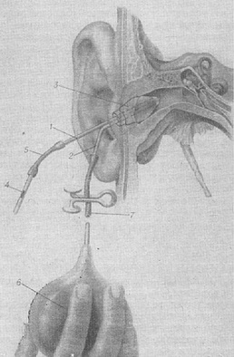 вушна манометрія