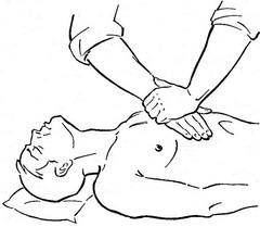 непрямий масаж серця