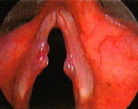 вузлики співаків