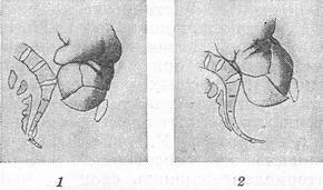 асінклітізм