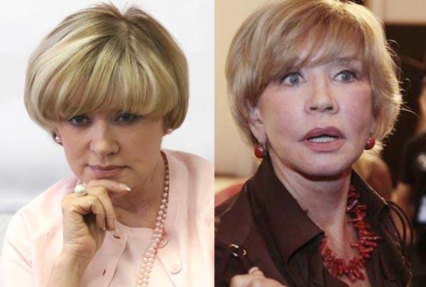 віра алентова після пластичної операції