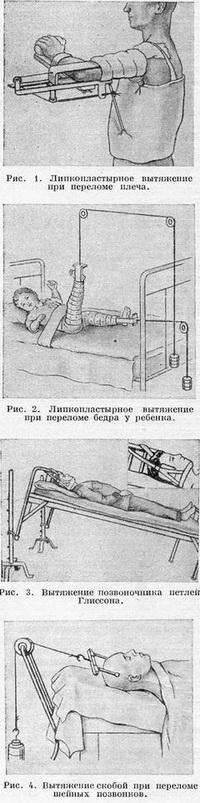 витягування