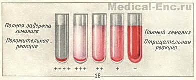 реакція Вассермана