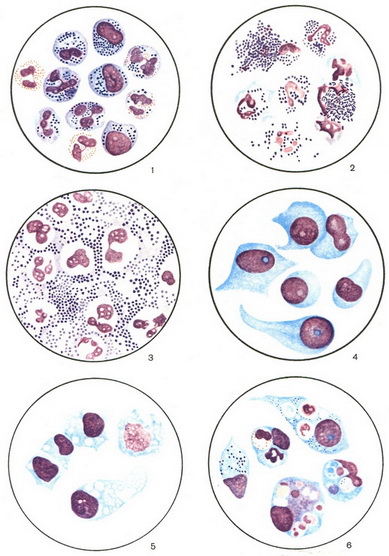 рановий ексудат
